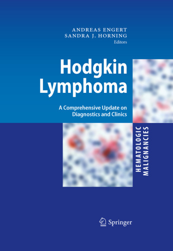 Hodgkin Lymphoma: A Comprehensive Update on Diagnostics and Clinics