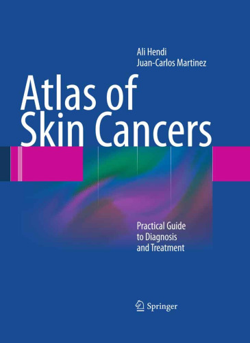Atlas of Skin Cancers: Practical Guide to Diagnosis and Treatment