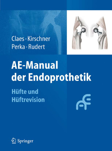 AE-Manual der Endoprothetik: Hüfte und Hüftrevision