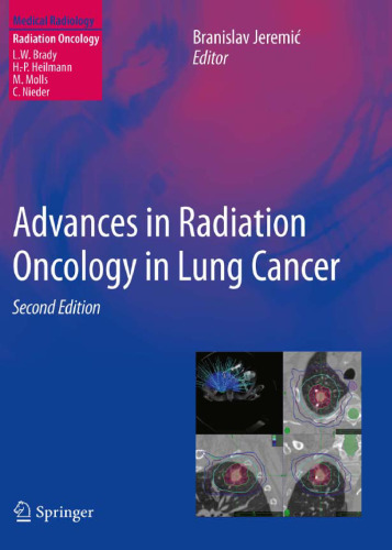 Advances in Radiation Oncology in Lung Cancer