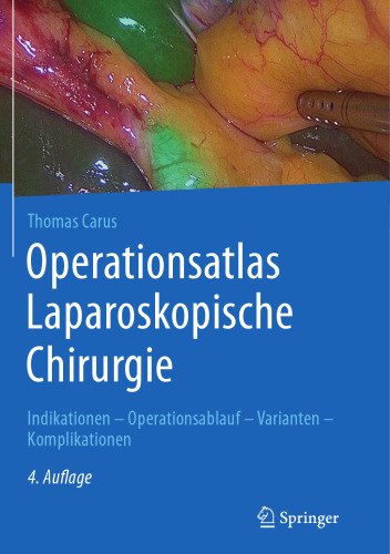 Operationsatlas Laparoskopische Chirurgie: Indikationen - Operationsablauf - Varianten - Komplikationen