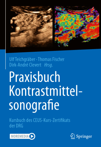 Praxisbuch Kontrastmittelsonografie: Kursbuch des CEUS-Kurs-Zertifikats der DRG (German Edition)