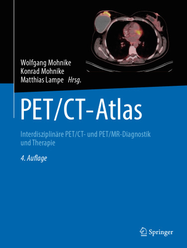 PET/CT-Atlas: Interdisziplinäre PET/CT- und PET/MR-Diagnostik und Therapie (German Edition)