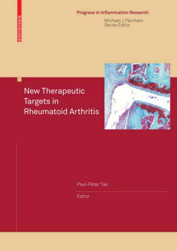 New Therapeutic Targets in Rheumatoid Arthritis (Progress in Inflammation Research)