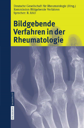 Bildgebende Verfahren in der Rheumatologie (German Edition)