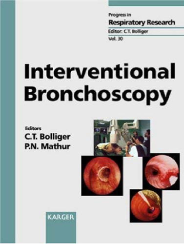 Interventional Bronchoscopy