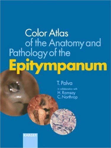 Colour Atlas of the Anatomy and Pathology of the Epitympanum