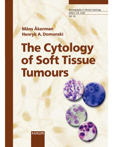 The Cytology of Soft Tissue Tumours (Monographs in Clinical Cytology)