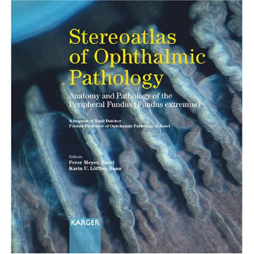 Stereoatlas of Ophthalmic Pathology: Anatomy and Pathology of the Peripheral Fundus ( Fundus extremus)