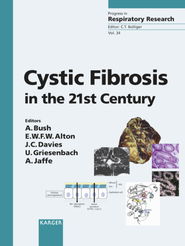 Cystic Fibrosis in the 21st Century (Progress in Respiratory Research)