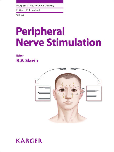 Peripheral Nerve Stimulation (Progress in Neurological Surgery)