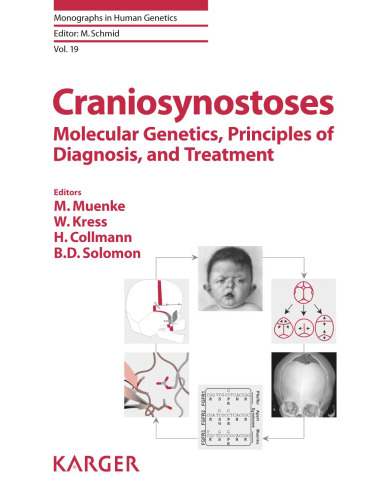 Craniosynostoses: Molecular Genetics, Principles of Diagnosis, and Treatment (Monographs in Human Genetics)