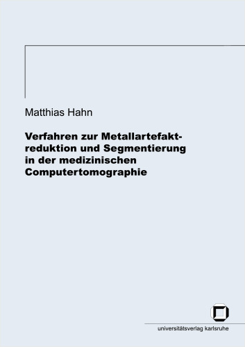 Verfahren zur Metallartefaktreduktion und Segmentierung in der medizinischen Computertomographie German