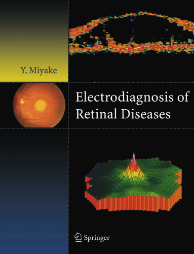 Electrodiagnosis of Retinal Disease