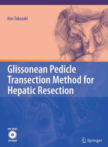 Glissonean Pedicle Transection Method for Hepatic Resection
