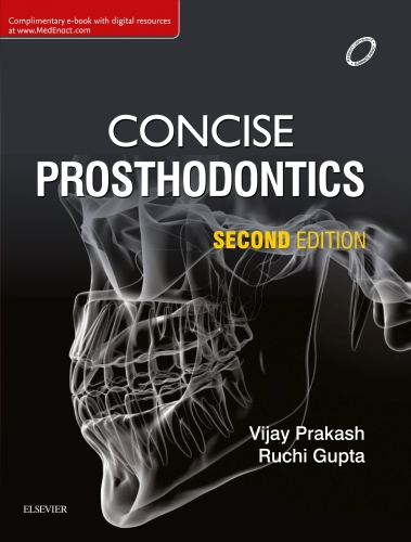 Concise Prosthodontics: Prep Manual for Undergraduates