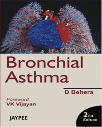 Bronchial Asthma, Second Edition