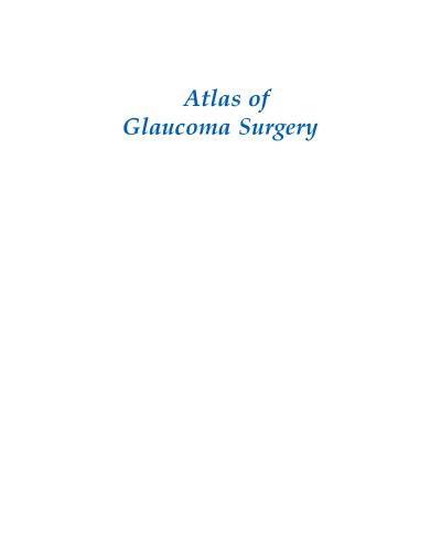 Atlas of Glaucoma Surgery