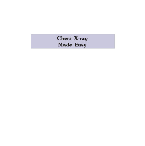 Chest X-ray Made Easy