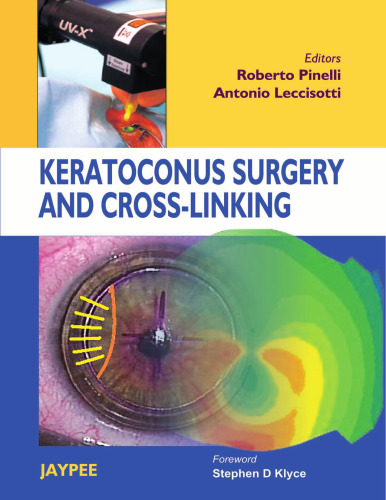 Keratoconus Surgery and Cross-linking