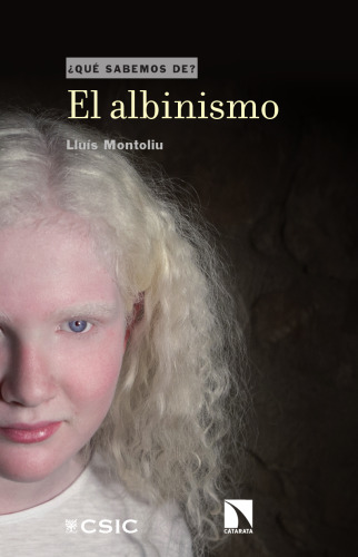 El albinismo (¿Qué sabemos de?) (Spanish Edition)