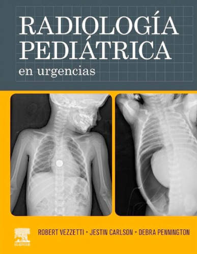 Radiologia Pediatrica En Urgencias