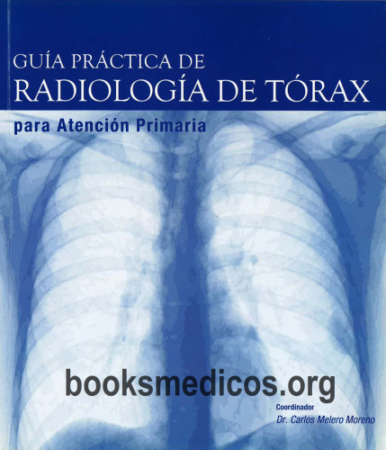 Guía Práctica de Radiología de Tórax para atención primaria
