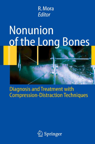 Nonunion of the Long Bones: Diagnosis and treatment with compression-distraction techniques