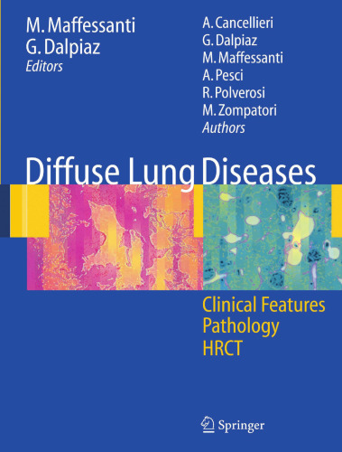 Diffuse Lung Diseases: Clinical Features, Pathology, HRCT