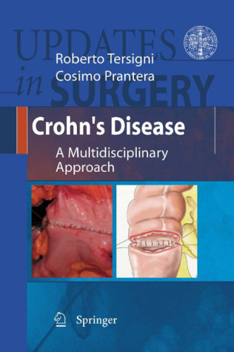 Crohn's Disease: A Multidisciplinary Approach ()