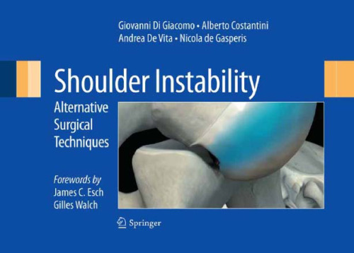 Shoulder Instability: Alternative Surgical Techniques
