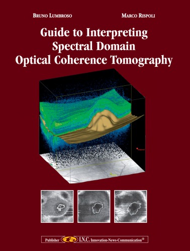 Guide to Interpreting Spectral Domain Opitcal Coherence Tomography