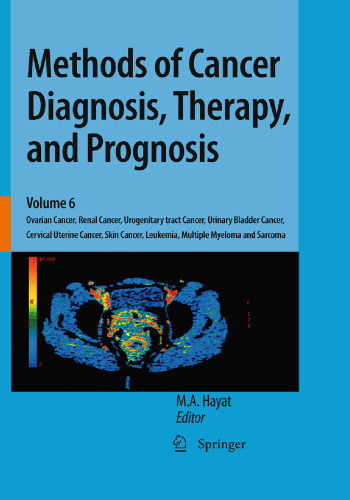 Methods of Cancer Diagnosis, Therapy and Prognosis, Volume 6: Ovarian Cancer, Renal Cancer, Urogenitary tract Cancer, Urinary Bladder Cancer, Cervical Uterine Cancer