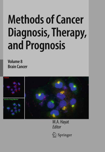 Methods of Cancer Diagnosis, Therapy, and Prognosis: Brain Cancer
