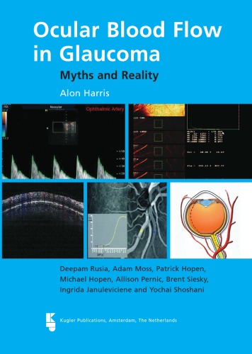 Ocular Blood Flow in Glaucoma Myths and Reality