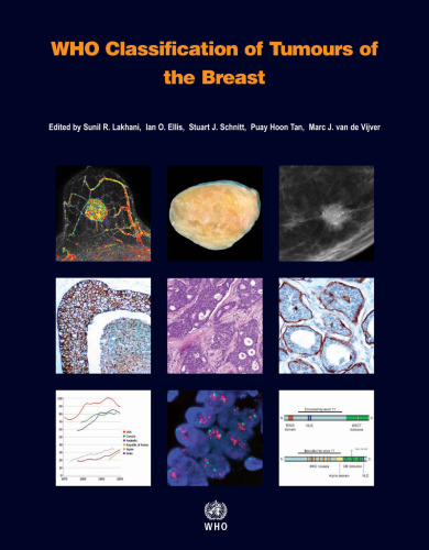 WHO Classification of Tumours of the Breast