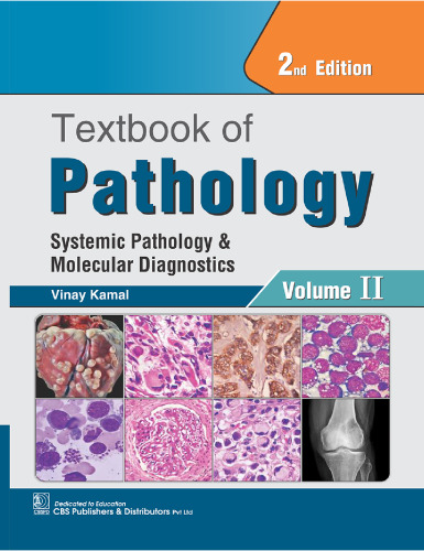 Textbook of Pathology: Systemic Pathology and Molecular Diagnostics, 2nd Edition, Vol-II