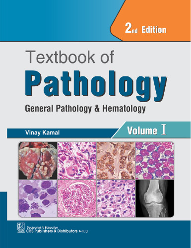 Textbook of Pathology: General Pathology and Hematology & Systemic Pathology and Molecular Diagnostics, 2nd Edition, Vol-I Vol-II