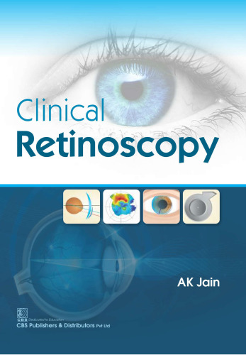 Clinical Retinoscopy