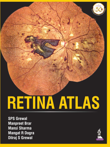 Retina Atlas
