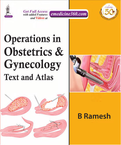 Operations in Obstetrics & Gynecology Text and Atlas