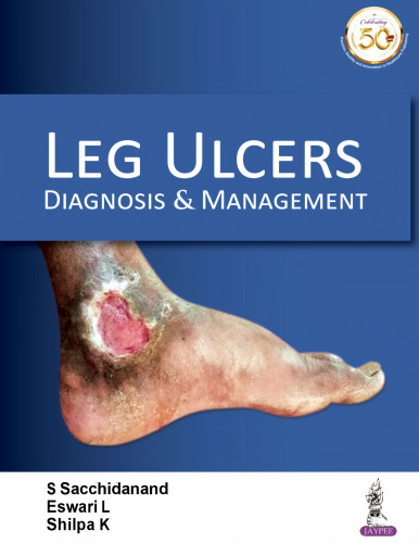Leg Ulcers: Diagnosis & Management