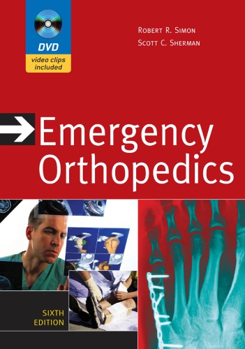 Emergency Orthopedics
