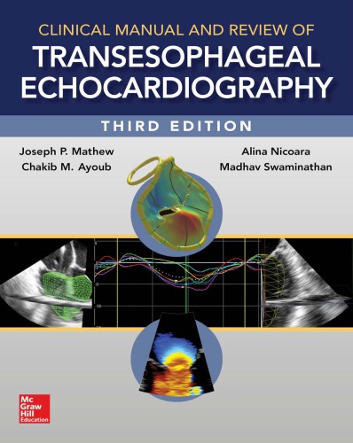 Clinical manual and review of transesophageal echocardiography