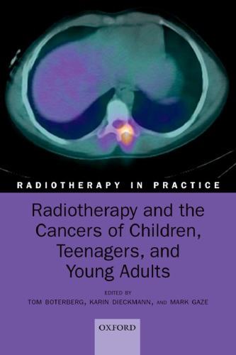 Radiotherapy and the Cancers of Children, Teenagers and Young Adults (Radiotherapy in Practice)