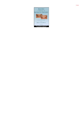Bleaching Techniques in Restorative Dentistry: An Illustrated Guide