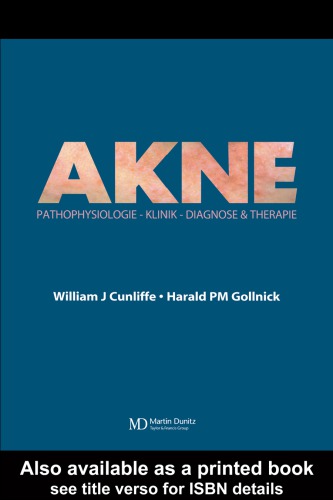 Akne : Diagnose und Therapie.