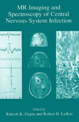 MR Imaging and Spectroscopy of Central Nervous System Infection