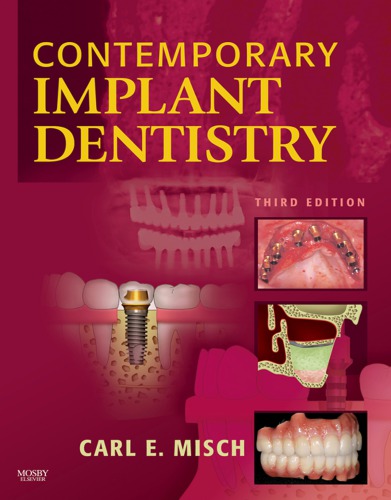Contemporary implant dentistry