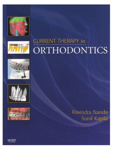 Current therapy in orthodontics